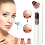 Turata USB Rechargeable Blackhead Remover - TheLuxaryShop