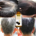 Darka Anti-Graying Hair Serum - TheLuxaryShop